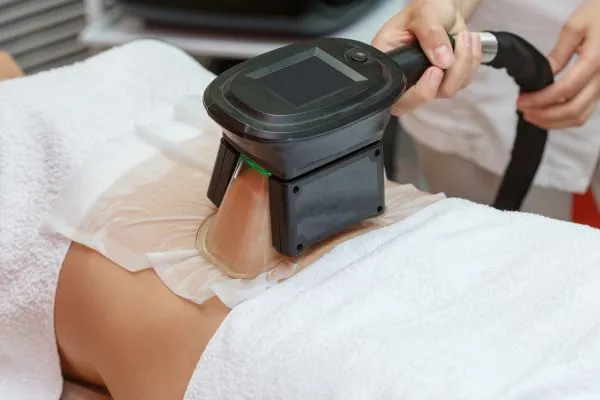 Image of person having fat freezing treatment to help weight gain St Neots