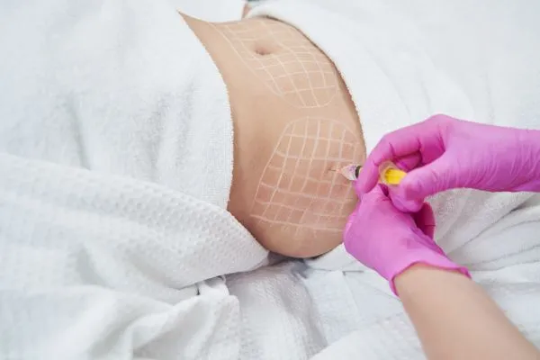image of fat dissolving injections on love handles to help combat weight gain St Neots