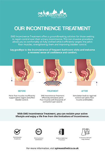 image to show how EMS treatment works for female urinary incontinence St Neots