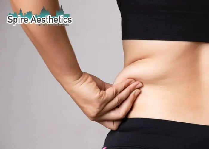 Image of woman pinching fat on their hips St Neots. Fat Freezing treatment