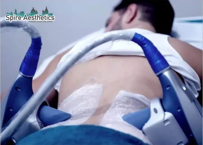 Man having fat freezing treatment done on love handles before a competitions St Neots to create a sculpted look.