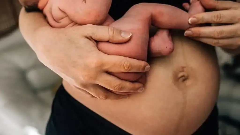 Why Is My Stomach Still Big After Pregnancy St Neots?